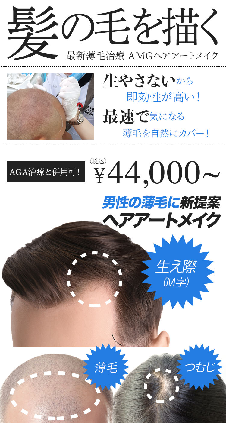 Amgヘアアートメイク 最新薄毛治療 ヘアロス対策 小顔効果